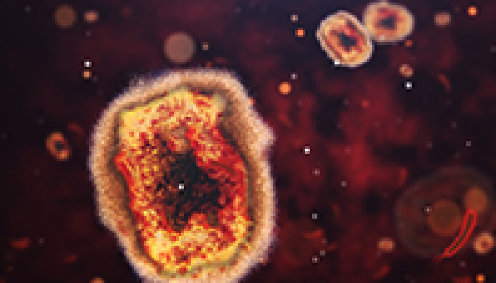 Monkeypox: Updated CDC Data On Vaccines and Cases