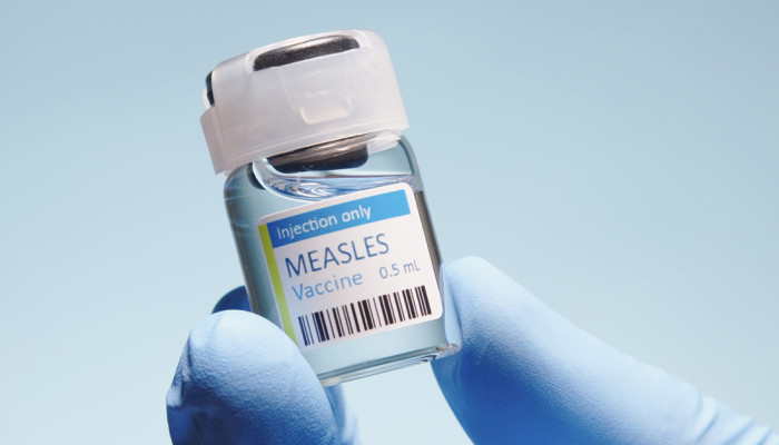 measles april
